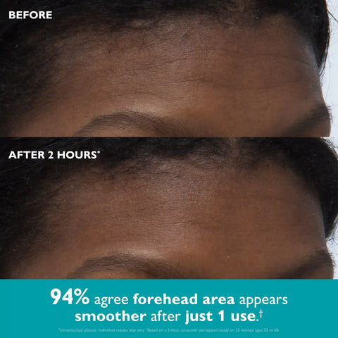 Peptide Skinjection Peptide Infused Face + Eye Tape