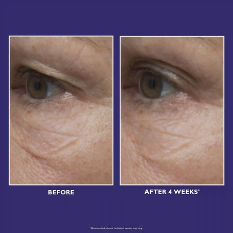 Ultimate Solution 5 Multitasking Eye Cream|15 ml / 0.5 fl oz